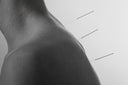 <p>ACUPUNTURA</p>