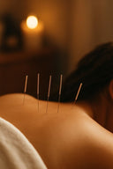 Acupuntura